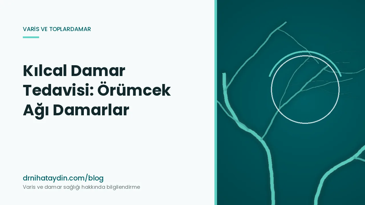 Kılcal Damar Tedavisi: Örümcek Ağı Damarlar
