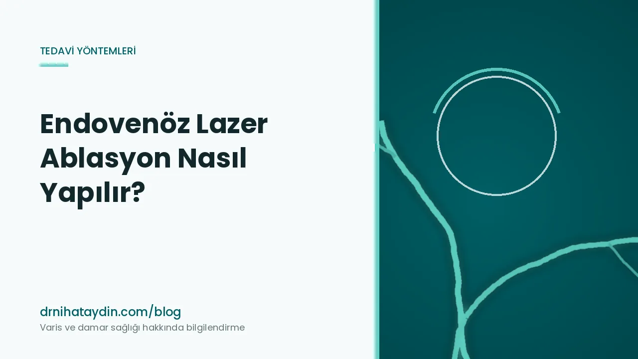 Endovenöz Lazer Ablasyon Nasıl Yapılır?