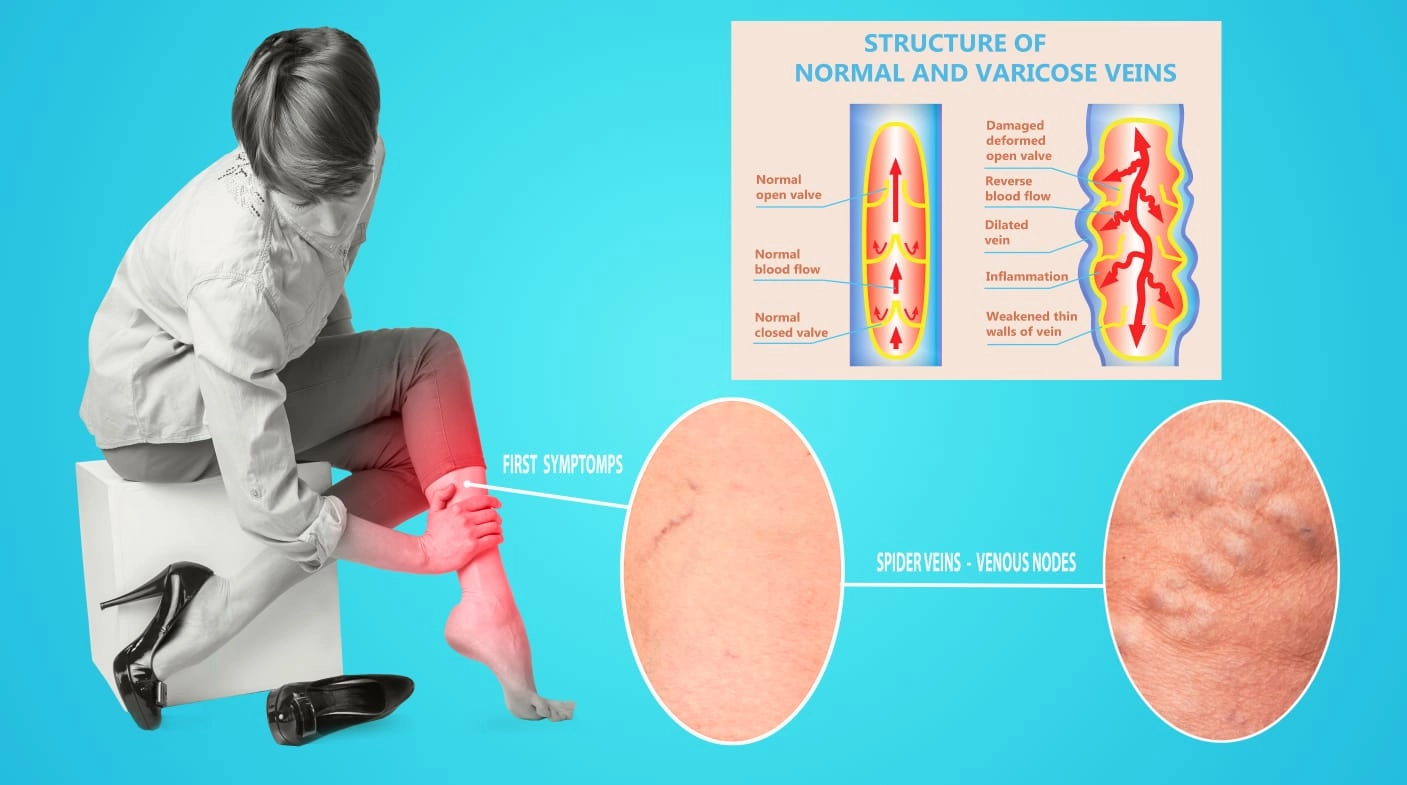 Varis Ağrısını Gün İçinde Azaltan Basit Pozisyon Değiştirme Teknikleri